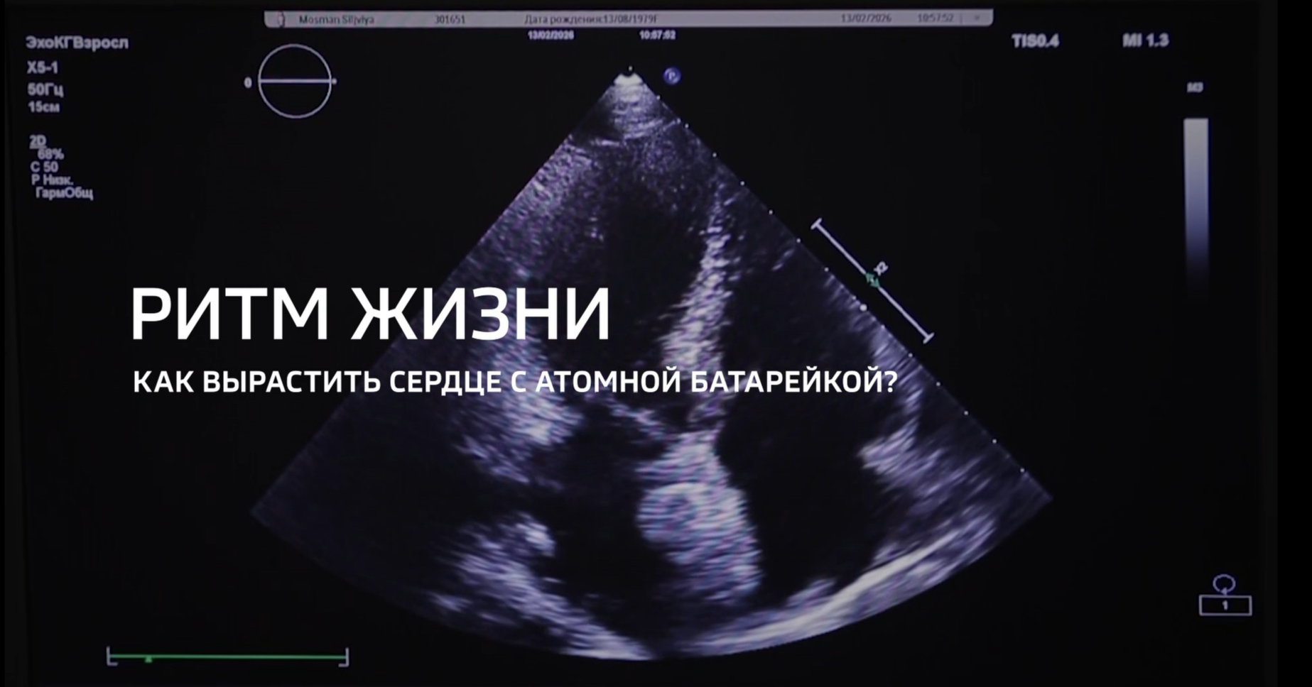 Видео: Специальный репортаж «Ритм жизни» телеканала «Россия 24» из цикла «Горизонты атома»
